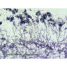 Набор микропрепаратов Bresser 100 шт., в кейсе 73765