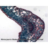 Набор микропрепаратов BRESSER 25 шт., в кейсе 74560